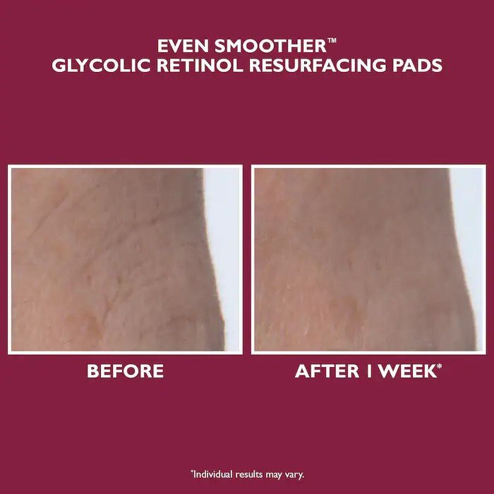 Peter Thomas Roth Even Smoother™ Glycolic Retinol Resurfacing Peel Pads - Image 2