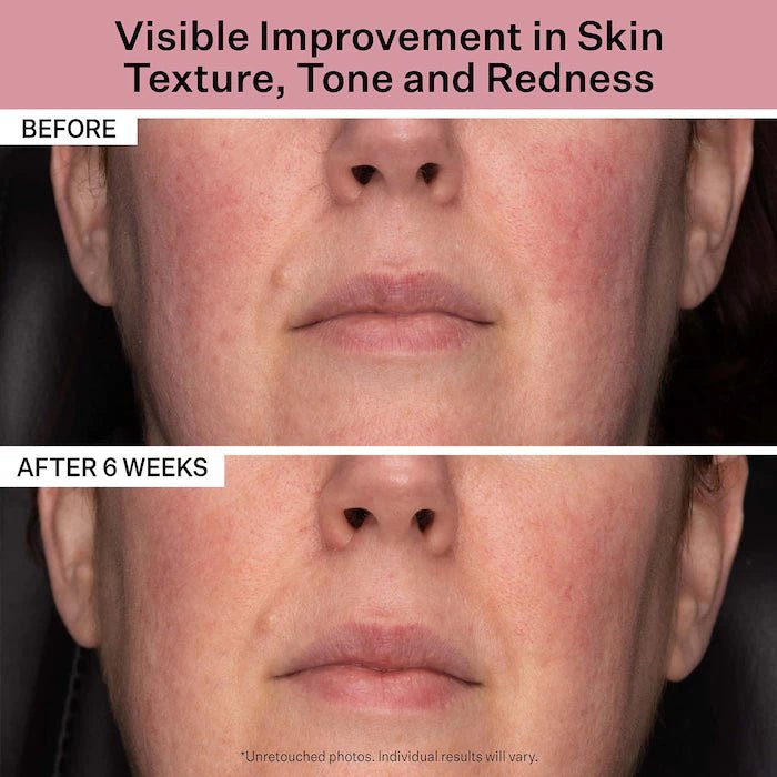 Advanced Retinol Daily Repair Face Moisturizer Broad Spectrum SPF 30 - Image 9
