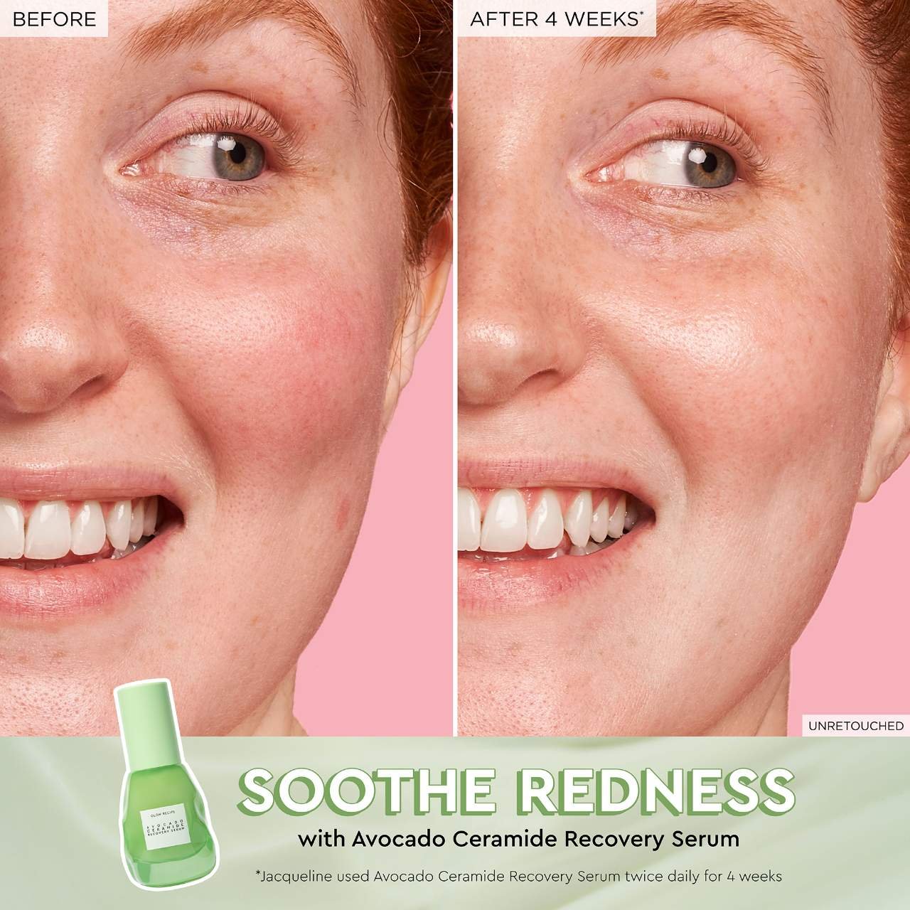 Avocado Soothing Skin Barrier Serum with Ceramides - Image 2