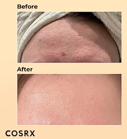 COSRX Snail Mucin 96% Power Repairing Essence 3.38 fl.oz - Image 3